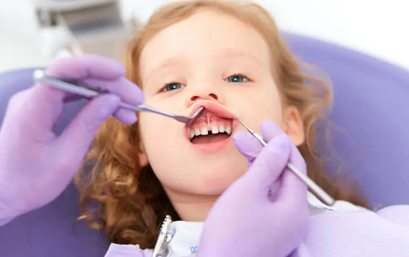 tongue and lip tie release for improved feed and speech of kids